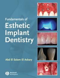 Fundamentals of Esthetic Implant Dentistry, Abdelsalam  Elaskary аудиокнига. ISDN43511832