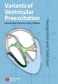 Variants of Ventricular Preexcitation,  audiobook. ISDN43513264