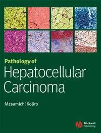 Pathology of Hepatocellular Carcinoma,  książka audio. ISDN43513736