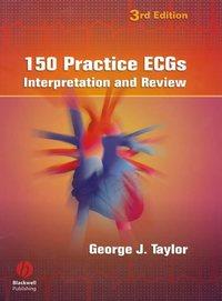 150 Practice ECGs,  audiobook. ISDN43514648