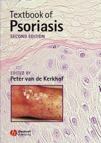 Textbook of Psoriasis - Peter C. M. Kerkhof