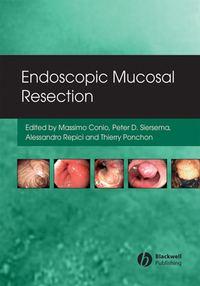 Endoscopic Mucosal Resection - Massimo Conio