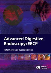 Advanced Digestive Endoscopy - Peter Cotton