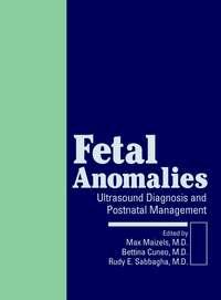Fetal Anomalies, Max  Maizels аудиокнига. ISDN43516392