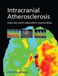 Intracranial Atherosclerosis - Jong Kim