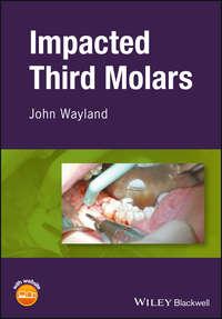Impacted Third Molars,  аудиокнига. ISDN43517344