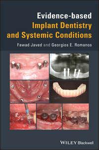 Evidence-based Implant Dentistry and Systemic Conditions, Georgios  Romanos аудиокнига. ISDN43517384