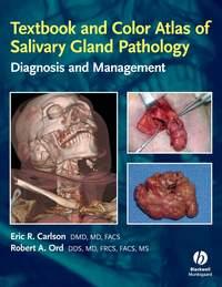 Textbook and Color Atlas of Salivary Gland Pathology, Robert  Ord książka audio. ISDN43517975
