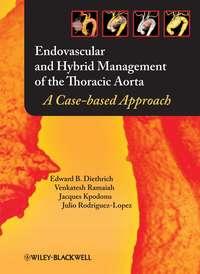 Endovascular and Hybrid Management of the Thoracic Aorta, Jacques  Kpodonu audiobook. ISDN43517983