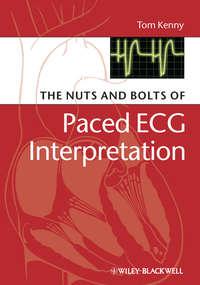 The Nuts and bolts of Paced ECG Interpretation,  аудиокнига. ISDN43518375