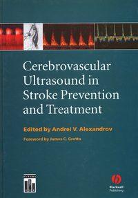 Cerebrovascular Ultrasound in Stroke Prevention and Treatment - Andrei Alexandrov