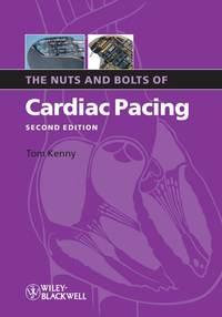 The Nuts and Bolts of Cardiac Pacing,  audiobook. ISDN43519079