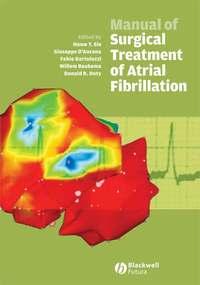 Manual of Surgical Treatment of Atrial Fibrillation, Giuseppe  DAncona Hörbuch. ISDN43519239