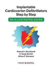 Implantable Cardioverter - Defibrillators Step by Step,  audiobook. ISDN43520791