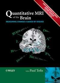 Quantitative MRI of the Brain,  audiobook. ISDN43521007