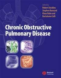 Chronic Obstructive Pulmonary Disease, Klaus  Rabe аудиокнига. ISDN43524767