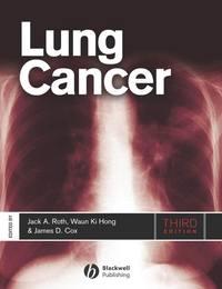 Lung Cancer,  audiobook. ISDN43530327