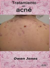 Tratamiento Del Acné, Owen Jones audiobook. ISDN63808446