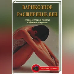 Варикозное расширение вен. Травы, которые помогут избежать операции, audiobook Ольги Абрамович. ISDN70700506